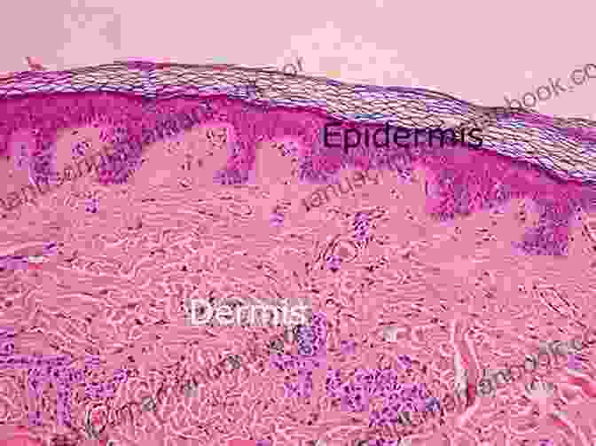 Microscopic Image Of The Skin's Layers, Showcasing The Epidermis, Dermis, And Subcutaneous Tissue. KNOW YOU BETTER HEAD TO TOE: Health Is The Greatest Wealth